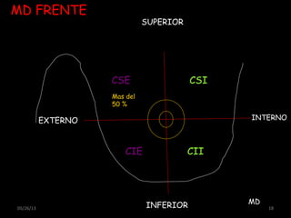 05/26/13 18
MD FRENTE
SUPERIOR
INFERIOR
INTERNOEXTERNO
CSE
CIE
MD
CSI
CII
Mas del
50 %
 