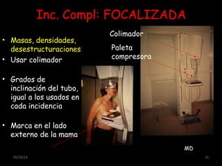 05/26/13 21
Inc. Compl: FOCALIZADA
• Masas, densidades,
desestructuraciones
• Usar colimador
• Grados de
inclinación del tubo,
igual a los usados en
cada incidencia
• Marca en el lado
externo de la mama
Colimador
Paleta
compresora
MD
 