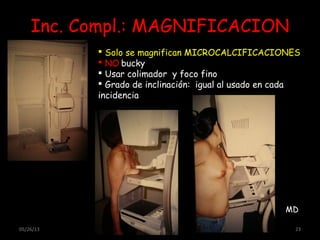 05/26/13 23
Inc. Compl.: MAGNIFICACION
 Solo se magnifican MICROCALCIFICACIONES
 NO bucky
 Usar colimador y foco fino
 Grado de inclinación: igual al usado en cada
incidencia
MD
 