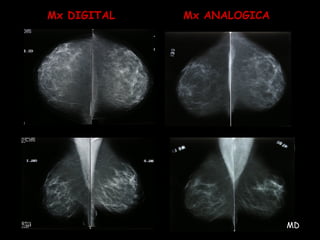 Mx DIGITAL Mx ANALOGICA
MD
 