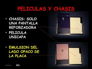 05/26/13 7
PELICULAS Y CHASIS
• CHASIS: SOLO
UNA PANTALLA
REFORZADORA
• PELICULA
UNICAPA
• EMULSION DEL
LADO OPACO DE
LA PLACA
MD
?
?
 
