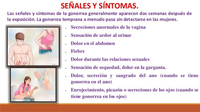 Image result for sintomas  de la  gonorrea