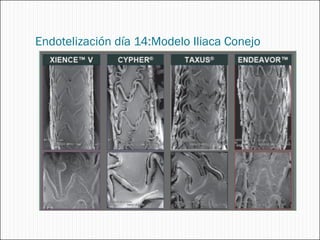 Endotelización día 14:Modelo Iliaca Conejo
 