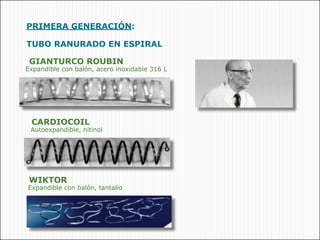 •PRIMERA GENERACIÓN:

•TUBO RANURADO EN ESPIRAL

• GIANTURCO ROUBIN
•Expandible con balón, acero inoxidable 316 L




 •CARDIOCOIL
 •Autoexpandible, nitinol




•WIKTOR
•Expandible con balón, tantalio
 