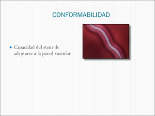 CONFORMABILIDAD



 Capacidad del stent de
  adaptarse a la pared vascular
 
