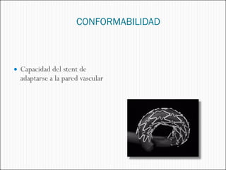 CONFORMABILIDAD



 Capacidad del stent de
  adaptarse a la pared vascular
 