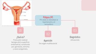 Ultrasonido
¿Qué es?
Protrusión nodular
benigna de la superficie
endometrial, constituida
por: glándulas, estroma
y vasos sanguíneos.
Pólipos (P)
FR: edad, la obesidad, la
hipertensión y el
tamoxifeno
01 03
02
Aparición
De origen multifactorial
Diagnóstico
 