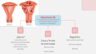 Dolor pelvico asociado
USG transvaginal
Biopsia
¿Qué es?
Coexistencia de
glándulas endometriales
en el miometrio,
endometrio y áreas
aledañas
Adenomiosis (A)
FR: multiparidad, tratamientos con
tamoxifeno, edad y la mayor
exposición a estrógenos.
01 03
02
Causa y formas
de enfermedad
Desconocida
Focal y difusa
Diagnóstico
 