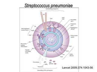 Lancet 2009;374:1543-56 Streptococcus pneumoniae 