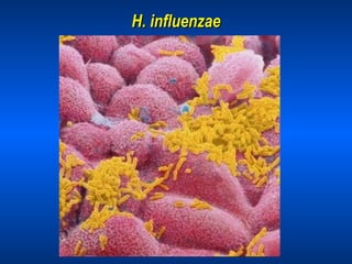 H. influenzae 