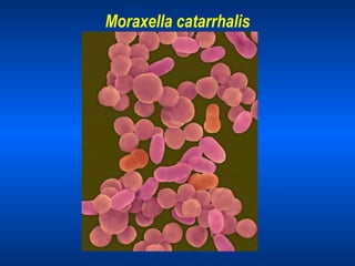 Moraxella catarrhalis 