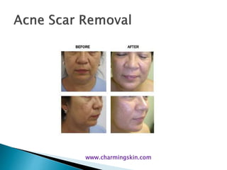 www.charmingskin.com
 
