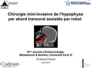 Chirurgie mini-invasive de l’hypophyse
par abord transoral assistée par robot
18ème
journée d’Endocrinologie,
Métabolisme & Nutrition. Université Paris VI
Dr Dorian Chauvet
6 juin 2014
 