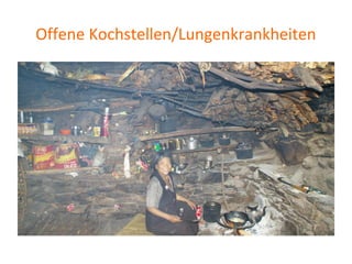 Offene Kochstellen/Lungenkrankheiten
 
