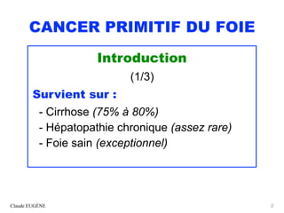 CANCER PRIMITIF DU FOIE (CHC). Après les recommandations 2019 du ...