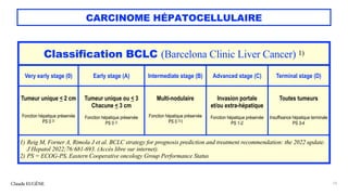 CARCINOME HÉPATOCELLULAIRE
Claude EUGÈNE 13
Classification BCLC (Barcelona Clinic Liver Cancer) 1)
Very early stage (0) Early stage (A) Intermediate stage (B) Advanced stage (C) Terminal stage (D)
Tumeur unique < 2 cm
Fonction hépatique préservée
PS 0 2)
Tumeur unique ou < 3
Chacune < 3 cm
Fonction hépatique préservée
PS 0 2)
Multi-nodulaire
Fonction hépatique préservée
PS 0 2) l
Invasion portale
et/ou extra-hépatique
Fonction hépatique préservée
PS 1-2
Toutes tumeurs
Insuffisance hépatique terminale
PS 3-4
1) Reig M, Forner A, Rimola J et al. BCLC strategy for prognosis prediction and treatment recommendation: the 2022 update.
J Hepatol 2022;76:681-693. (Accès libre sur internet).
2) PS = ECOG-PS, Eastern Cooperative oncology Group Performance Status
 
