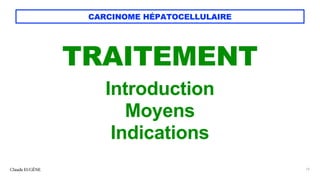 CARCINOME HÉPATOCELLULAIRE
TRAITEMENT
Introduction
Moyens
Indications
Claude EUGÈNE 15
 