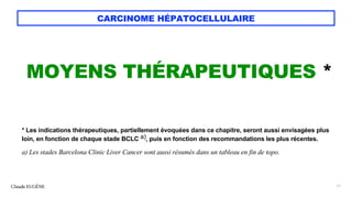 CARCINOME HÉPATOCELLULAIRE
MOYENS THÉRAPEUTIQUES *
* Les indications thérapeutiques, partiellement évoquées dans ce chapitre, seront aussi envisagées plus
loin, en fonction de chaque stade BCLC a), puis en fonction des recommandations les plus récentes.
a) Les stades Barcelona Clinic Liver Cancer sont aussi résumés dans un tableau en fin de topo.
Claude EUGÈNE 17
 