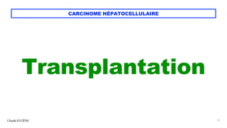 CARCINOME HÉPATOCELLULAIRE
Transplantation
Claude EUGÈNE 19
 