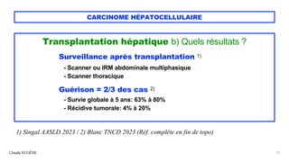 CARCINOME HÉPATOCELLULAIRE
Transplantation hépatique b) Quels résultats ?
Surveillance après transplantation 1)
- Scanner ou IRM abdominale multiphasique
- Scanner thoracique
Guérison = 2/3 des cas 2)
- Survie globale à 5 ans: 63% à 80%
- Récidive tumorale: 4% à 20%
Claude EUGÈNE 22
1) Singal AASLD 2023 / 2) Blanc TNCD 2023 (Réf. complète en fin de topo)
 