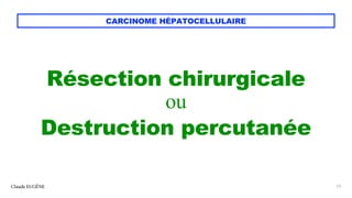 CARCINOME HÉPATOCELLULAIRE
Résection chirurgicale
ou
Destruction percutanée
Claude EUGÈNE 23
 