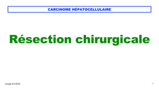 CARCINOME HÉPATOCELLULAIRE
Résection chirurgicale
Claude EUGÈNE 25
 