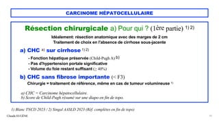 CARCINOME HÉPATOCELLULAIRE
Claude EUGÈNE 26
1) Blanc TNCD 2023 / 2) Singal AASLD 2023 (Réf. complètes en fin de topo)
Résection chirurgicale a) Pour qui ? (1ère partie) 1) 2)
Idéalement: résection anatomique avec des marges de 2 cm
Traitement de choix en l'absence de cirrhose sous-jacente
a) CHC a) sur cirrhose 1) 2)
- Fonction hépatique préservée (Child-Pugh A) b)
- Pas d'hypertension portale significative
- Volume du foie restant suffisant (> 40%)
b) CHC sans fibrose importante (< F3)
Chirurgie = traitement de référence, même en cas de tumeur volumineuse 1)
a) CHC = Carcinome hépatocellulaire.
b) Score de Child-Pugh résumé sur une diapo en fin de topo.
 