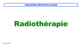 CARCINOME HÉPATOCELLULAIRE
Radiothérapie
Claude EUGÈNE 37
 