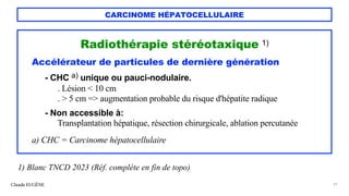 CARCINOME HÉPATOCELLULAIRE
Radiothérapie stéréotaxique 1)
Accélérateur de particules de dernière génération
- CHC a) unique ou pauci-nodulaire.
. Lésion < 10 cm
. > 5 cm => augmentation probable du risque d'hépatite radique
- Non accessible à:
Transplantation hépatique, résection chirurgicale, ablation percutanée
a) CHC = Carcinome hépatocellulaire
Claude EUGÈNE 41
1) Blanc TNCD 2023 (Réf. complète en fin de topo)
 