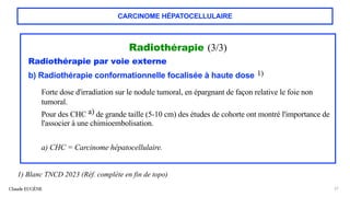 CARCINOME HÉPATOCELLULAIRE
Radiothérapie (3/3)
Radiothérapie par voie externe
b) Radiothérapie conformationnelle focalisée à haute dose 1)
Forte dose d'irradiation sur le nodule tumoral, en épargnant de façon relative le foie non
tumoral.
Pour des CHC a) de grande taille (5-10 cm) des études de cohorte ont montré l'importance de
l'associer à une chimioembolisation.
a) CHC = Carcinome hépatocellulaire.
Claude EUGÈNE 67
1) Blanc TNCD 2023 (Réf. complète en fin de topo)
 