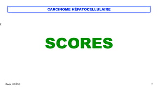 CARCINOME HÉPATOCELLULAIRE
SCORES
Claude EUGÈNE 74
y
 