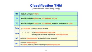 Classification TNM
(American Liver Tumor Study Group)
75
T1 Nodule unique < 2 cm
T2 Nodule unique 2-5 cm ou 2-3 nodules < 3 cm
T3 Nodule unique > 5 cm ou 2-3 nodules, dont au moins un > 3 cm
T4a > 4 nodules, quelle que soit la taille
T4b
T2, T3, T4a plus envahissement vasculaire :
veine porte ou veine hépatique intra-hépatiques
N1 Atteinte ganglionnaire régionale (portal hepatis)
M1
Atteinte métastatique
ou veine porte ou veine hépatique extra-hépatiques
 