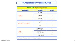 CARCINOME HEPATOCELLULAIRE
Claude EUGÈNE 77
Score AFP (Alpha foetoprotéine) 1)
Paramètre Classe Score
Taille
< 3 cm 0
3-6 cm 1
> 6 cm 4
Nombre de nodules
< 3 0
> 4 2
AFP
< 100 ng/ml 0
10-1000 ng/ml 2
> 1000 ng/ml 3
1) Blanc TNCD 2023 (Réf. complète en fin de topo)
 