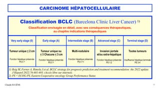 CARCINOME HÉPATOCELLULAIRE
Claude EUGÈNE 78
Classification BCLC (Barcelona Clinic Liver Cancer) 1)
Classification envisagée en détail, avec ses conséquences thérapeutiques,
au chapitre indications thérapeutiques
Very early stage (0) Early stage (A) Intermediate stage (B) Advanced stage (C) Terminal stage (D)
Tumeur unique < 2 cm
Fonction hépatique préservée
PS 0 2)
Tumeur unique ou
< 3 Chacune < 3 cm
Fonction hépatique préservée
PS 0 2)
Multi-nodulaire
Fonction hépatique préservée
PS 0 2) l
Invasion portale
et/ou extra-hépatique
Fonction hépatique préservée
PS 1-2
Toutes tumeurs
Insuffisance hépatique terminale
PS 3-4
1) Reig M, Forner A, Rimola J et al. BCLC strategy for prognosis prediction and treatment recommendation: the 2022 update.
J Hepatol 2022;76:681-693. (Accès libre sur internet).
2) PS = ECOG-PS, Eastern Cooperative oncology Group Performance Status
 