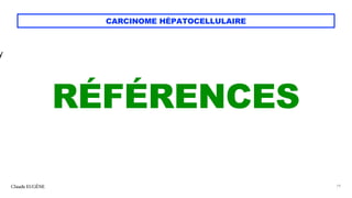 CARCINOME HÉPATOCELLULAIRE
RÉFÉRENCES
Claude EUGÈNE 79
y
 