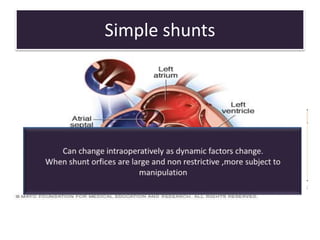 Simple shunts
• No associated obstructive lesions eg ASD
• Outflow resistance = SVR & PVR
 