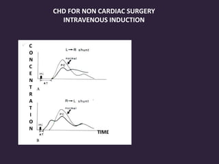 CHD FOR NON CARDIAC SURGERY
INTRAVENOUS INDUCTION
TIME
C
O
N
C
E
N
T
R
A
T
I
O
N
 