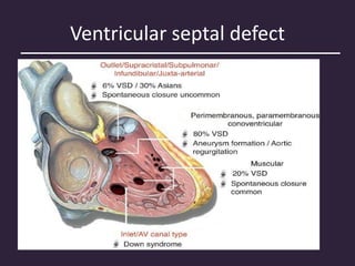 Ventricular septal defect
• An opening in the ventricular septum that permit
communication between RV and LV
• Membranous or perimembranous type
most common (80%)
• Subpulmonary or supracristal type
• Muscular defects
 
