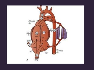 Congenital heart disease
