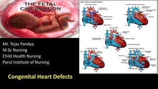 Mr. Tejas Pandya
M.Sc Nursing
Child Health Nursing
Parul Institute of Nursing
Congenital Heart Defects
 