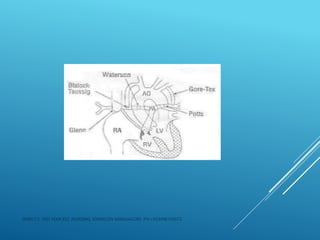 JERIN.T.S, 3RD YEAR BSC NURSING, KRSMCON MANGALORE. PH:+919496743672
 