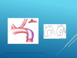 JERIN.T.S, 3RD YEAR BSC NURSING, KRSMCON MANGALORE. PH:+919496743672
 