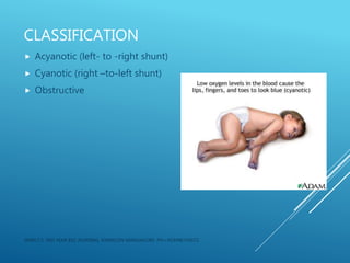 CLASSIFICATION
 Acyanotic (left- to -right shunt)
 Cyanotic (right –to-left shunt)
 Obstructive
JERIN.T.S, 3RD YEAR BSC NURSING, KRSMCON MANGALORE. PH:+919496743672
 