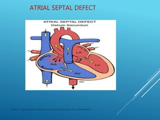 ATRIAL SEPTAL DEFECT
JERIN.T.S, 3RD YEAR BSC NURSING, KRSMCON MANGALORE. PH:+919496743672
 