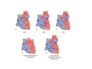 CHD.pptx
