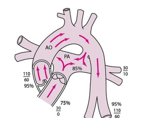 CHD.pptx