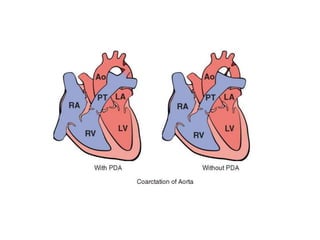 CHD.pptx