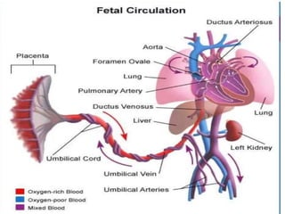 CHD.pptx