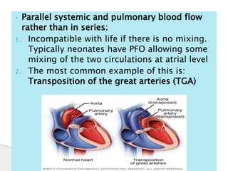 Chd essentials | PPT
