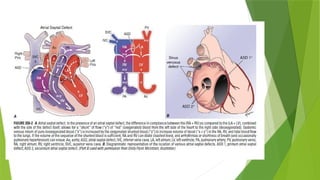 Comprehensive Overview of Congenital Heart Disease Management in ...
